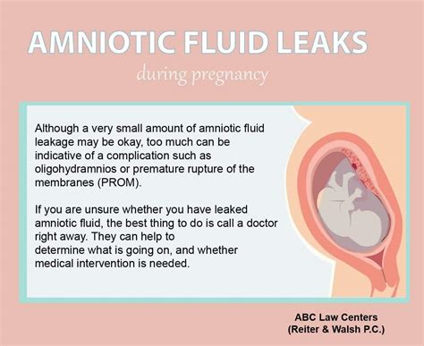 does leaking amniotic fluid smell|Amniotic Fluid: Color, Smell, Function & Disorders